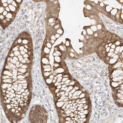 Invitrogen MIPEP Polyclonal Antibody 100 &mu;L; Unconjugated:Antibodies,