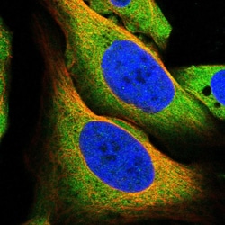 Invitrogen TRPML1 Polyclonal Antibody 100 &mu;L; Unconjugated:Antibodies,