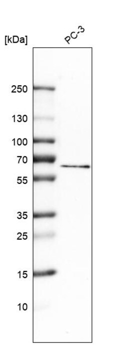 Invitrogen TRPML1 Polyclonal Antibody 100 &mu;L; Unconjugated:Antibodies,