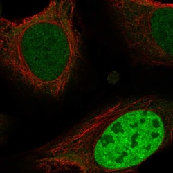 Invitrogen ING4 Polyclonal Antibody 100 &mu;L; Unconjugated:Antibodies,
