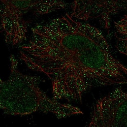Invitrogen PIEZO2 Polyclonal Antibody 100 μL; Unconjugated:Antibodies,