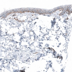 Invitrogen Laminin alpha-1 Polyclonal Antibody 100 &mu;L; Unconjugated:Antibodies,