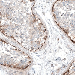 Invitrogen Laminin alpha-1 Polyclonal Antibody 100 &mu;L; Unconjugated:Antibodies,