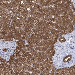 Invitrogen UGP2 Polyclonal Antibody 100 &mu;L; Unconjugated:Antibodies,