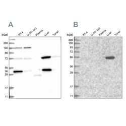 Invitrogen UGP2 Polyclonal Antibody 100 &mu;L | Buy Online | Invitrogen&trade; | Fisher Scientific