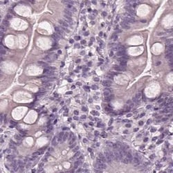 Opticin Polyclonal Antibody:Antibodies, Polyclonal