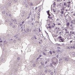 Opticin Polyclonal Antibody:Antibodies, Polyclonal