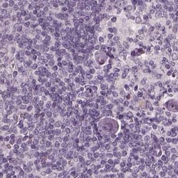 Opticin Polyclonal Antibody:Antibodies, Polyclonal