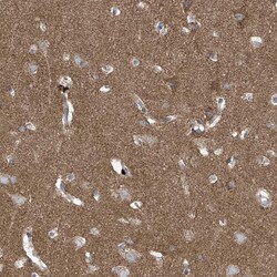 Invitrogen P2X7 Polyclonal Antibody 100 &mu;L; Unconjugated:Antibodies,