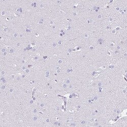 Invitrogen IKAROS Polyclonal Antibody:Antibodies:Primary Antibodies