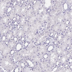 Invitrogen IKAROS Polyclonal Antibody:Antibodies:Primary Antibodies
