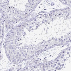 Invitrogen IKAROS Polyclonal Antibody:Antibodies:Primary Antibodies