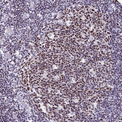 Invitrogen IKAROS Polyclonal Antibody:Antibodies:Primary Antibodies