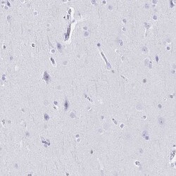 Invitrogen IKAROS Polyclonal Antibody 100 &mu;L; Unconjugated:Antibodies,