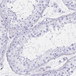 Invitrogen IKAROS Polyclonal Antibody 100 &mu;L; Unconjugated:Antibodies,