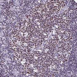 Invitrogen IKAROS Polyclonal Antibody 100 &mu;L; Unconjugated:Antibodies,