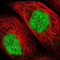 Invitrogen UPP2 Polyclonal Antibody 100 μL; Unconjugated:Antibodies,
