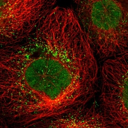 Invitrogen UPP2 Polyclonal Antibody 100 &mu;L; Unconjugated:Antibodies,