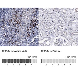 Invitrogen TRPM2 Polyclonal Antibody 100 μL; Unconjugated:Antibodies,