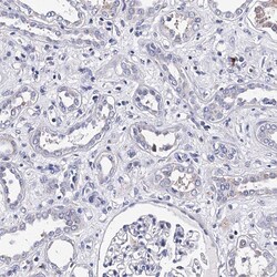 Invitrogen TRPM2 Polyclonal Antibody 100 μL; Unconjugated:Antibodies,