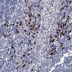Invitrogen TRPM2 Polyclonal Antibody 100 μL; Unconjugated:Antibodies,