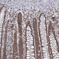 Invitrogen TREX1 Polyclonal Antibody 100 &mu;L; Unconjugated:Antibodies,