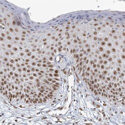 Invitrogen TREX1 Polyclonal Antibody 100 &mu;L; Unconjugated:Antibodies,