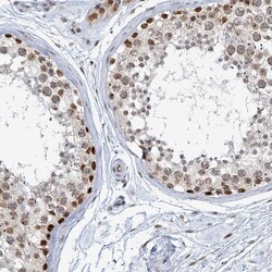 Invitrogen TREX1 Polyclonal Antibody 100 &mu;L; Unconjugated:Antibodies,