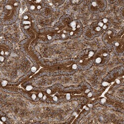 Invitrogen TRIP Polyclonal Antibody 100 &mu;L; Unconjugated:Antibodies,