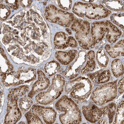 Invitrogen TRIP Polyclonal Antibody 100 &mu;L; Unconjugated:Antibodies,