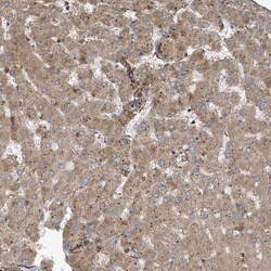 Invitrogen TRIP Polyclonal Antibody 100 &mu;L; Unconjugated:Antibodies,