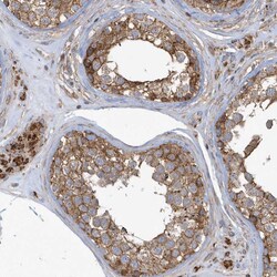 Invitrogen TRIP Polyclonal Antibody 100 &mu;L; Unconjugated:Antibodies,