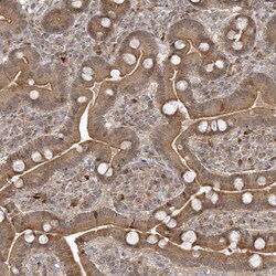 Invitrogen TRIP Polyclonal Antibody:Antibodies:Primary Antibodies