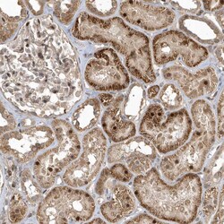 Invitrogen TRIP Polyclonal Antibody:Antibodies:Primary Antibodies