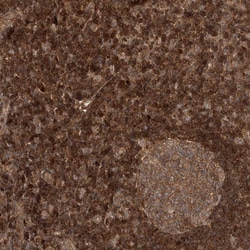 Invitrogen ALS2CR1 Polyclonal Antibody 100 μL; Unconjugated:Antibodies,