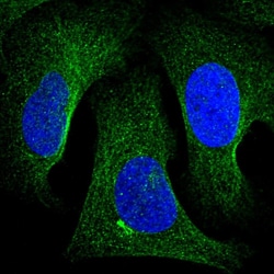 Invitrogen Tankyrase 2 Polyclonal Antibody 100 &mu;L; Unconjugated:Antibodies,