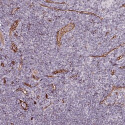 Invitrogen CD34 Polyclonal Antibody 100 μL; Unconjugated:Antibodies,