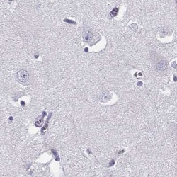 Invitrogen CRX Polyclonal Antibody 100 &mu;L; Unconjugated:Antibodies,