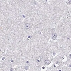 Invitrogen CRX Polyclonal Antibody 100 &mu;L; Unconjugated:Antibodies,
