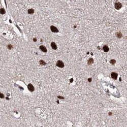 Invitrogen SR140 Polyclonal Antibody 100 μL; Unconjugated:Antibodies,