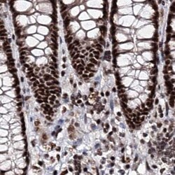 Invitrogen SR140 Polyclonal Antibody 100 μL; Unconjugated:Antibodies,