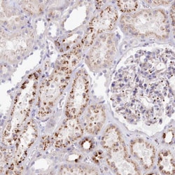 Invitrogen CLN2 Polyclonal Antibody:Antibodies:Primary Antibodies