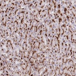 Invitrogen CLN2 Polyclonal Antibody:Antibodies:Primary Antibodies