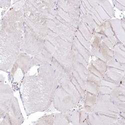 Invitrogen CLN2 Polyclonal Antibody:Antibodies:Primary Antibodies