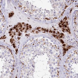 Invitrogen CLN2 Polyclonal Antibody:Antibodies:Primary Antibodies