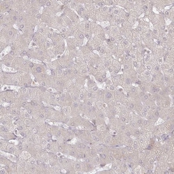 Invitrogen Arylsulfatase B Polyclonal Antibody 100 &mu;L; Unconjugated:Antibodies,