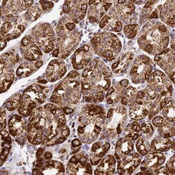 Invitrogen DRAK1 Polyclonal Antibody 100 &mu;L; Unconjugated:Antibodies,