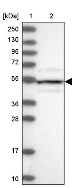 Invitrogen DRAK1 Polyclonal Antibody 100 &mu;L | Buy Online | Invitrogen&trade; | Fisher Scientific