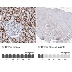 Invitrogen MCCC2 Polyclonal Antibody 100 &mu;L; Unconjugated:Antibodies,
