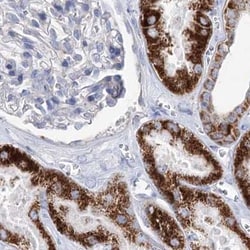 Invitrogen MCCC2 Polyclonal Antibody 100 &mu;L; Unconjugated:Antibodies,